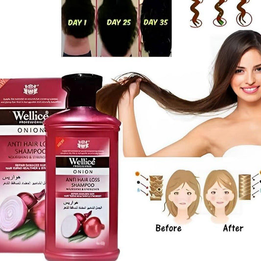 Anti-Hair Loss Onion Shampoo 400ml